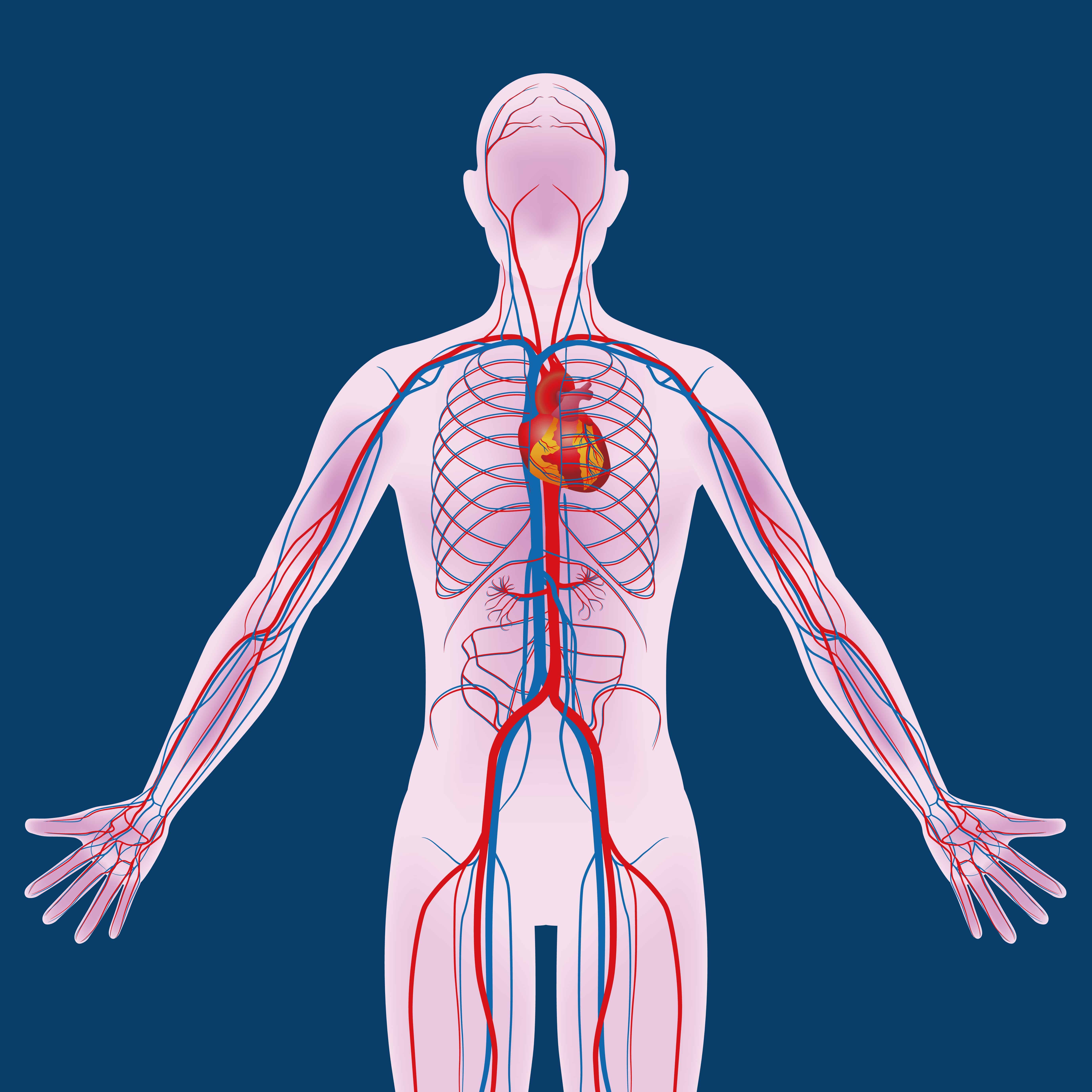 Vena cava filter problems doctorvisit