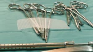 What Are The Symptoms Of Hernia Mesh Failure?