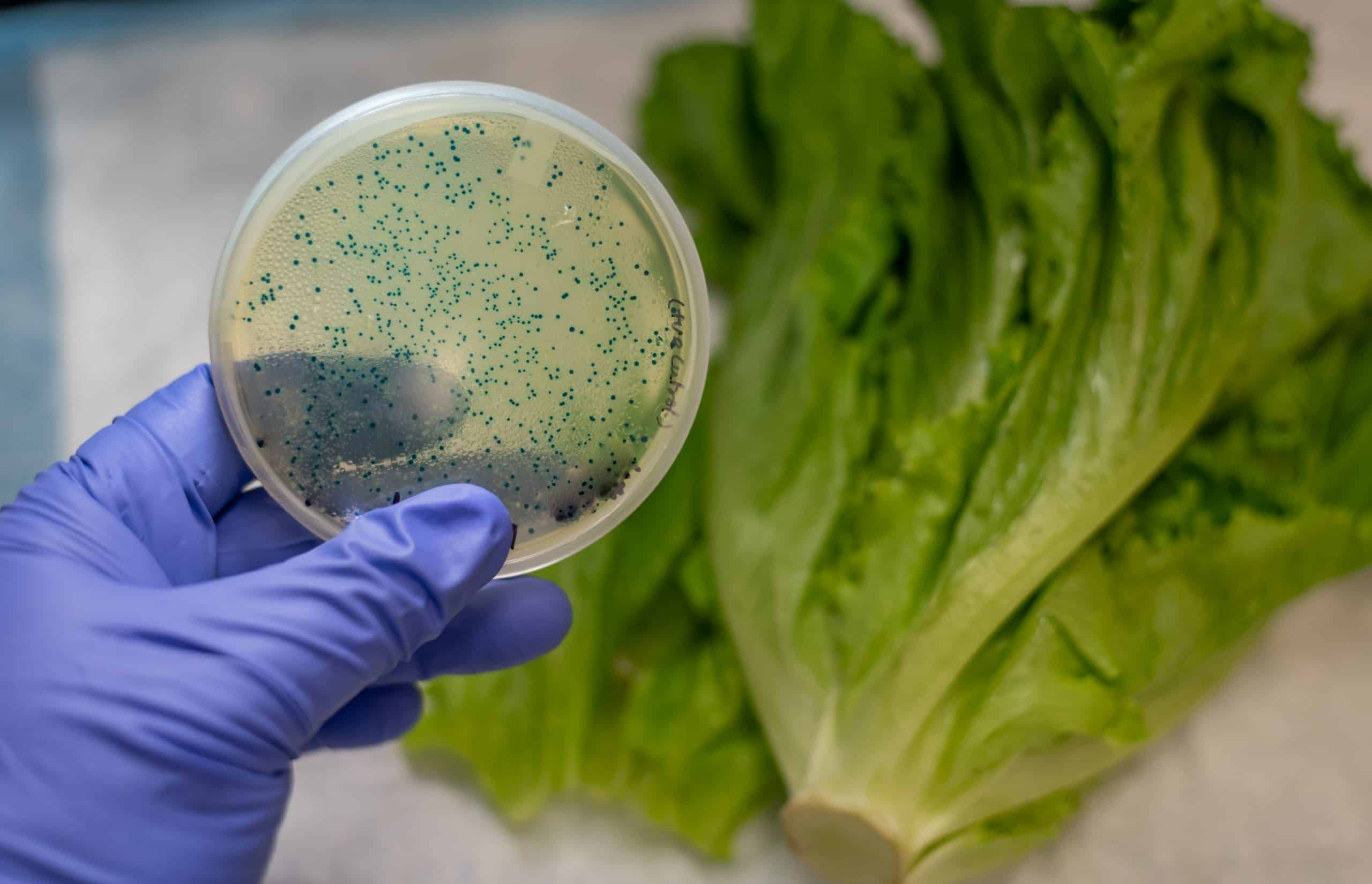 bacteria